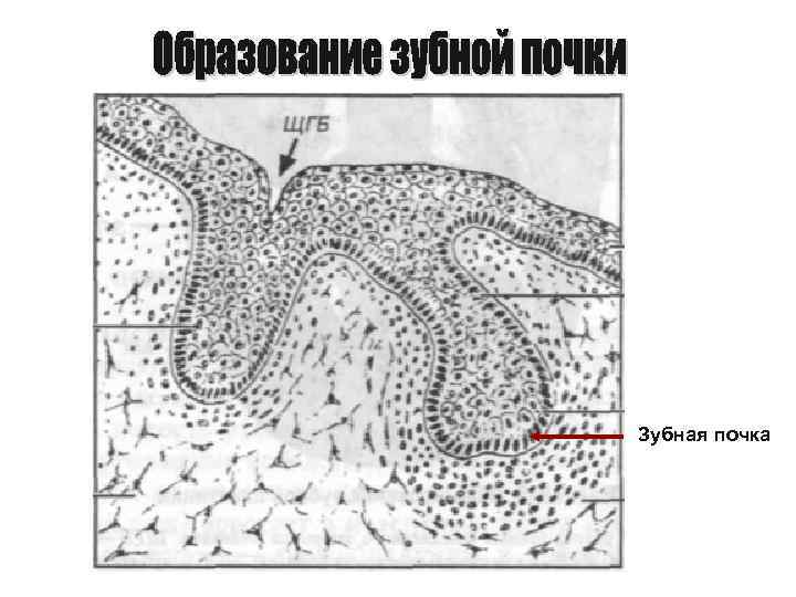 Зубная почка 