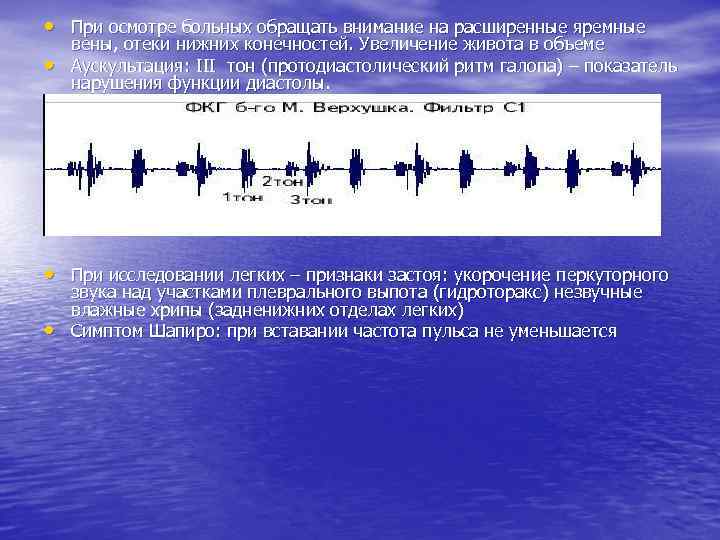 Ритм галопа при каком заболевании