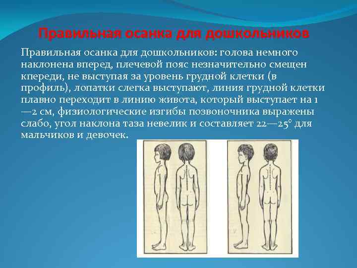 Правильная осанка для дошкольников: голова немного наклонена вперед, плечевой пояс незначительно смещен кпереди, не