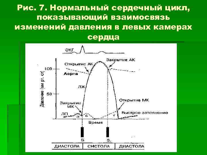 Рис. 7. Нормальный сердечный цикл, показывающий взаимосвязь изменений давления в левых камерах сердца 