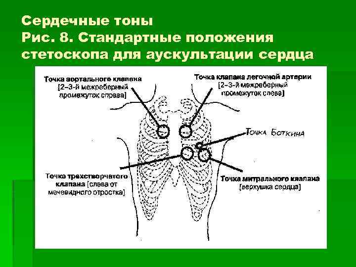 Сердечные тоны Рис. 8. Стандартные положения стетоскопа для аускультации сердца 