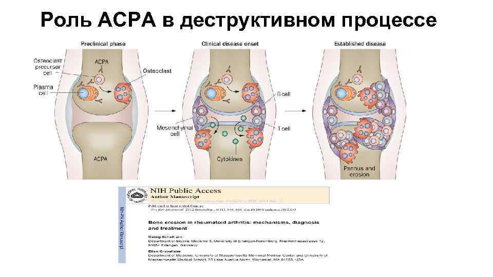 Роль ACPA в деструктивном процессе 