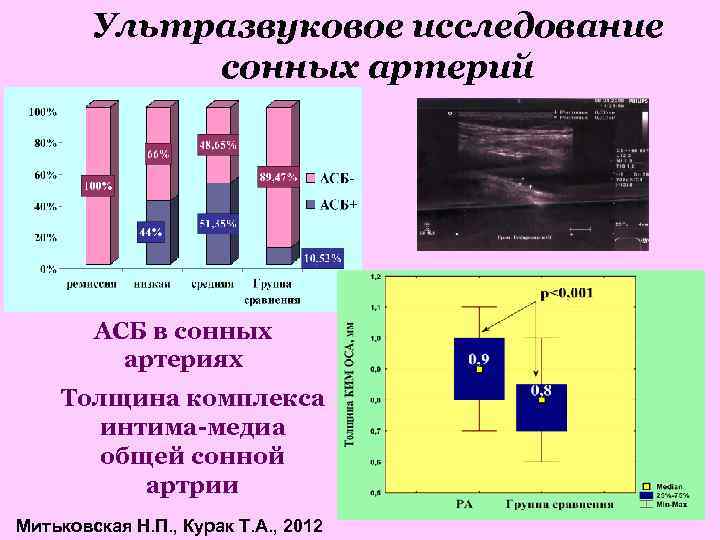 Уаз сонных артерий