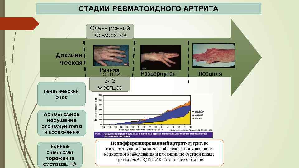 СТАДИИ РЕВМАТОИДНОГО АРТРИТА Очень ранний <3 месяцев Доклини ческая Генетический риск Асимптомное нарушение атоиммунитета