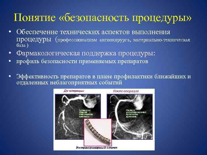 Понятие «безопасность процедуры» • Обеспечение технических аспектов выполнения процедуры (профессионализм ангиохирурга, материально-техническая база )