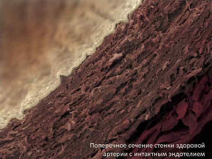 Поперечное сечение стенки здоровой Slide 3 артерии с интактным эндотелием 