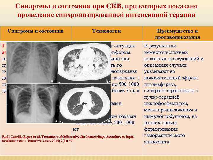 Синдромы и состояния при СКВ, при которых показано проведение синхронизированной интенсивной терапии Синдромы и