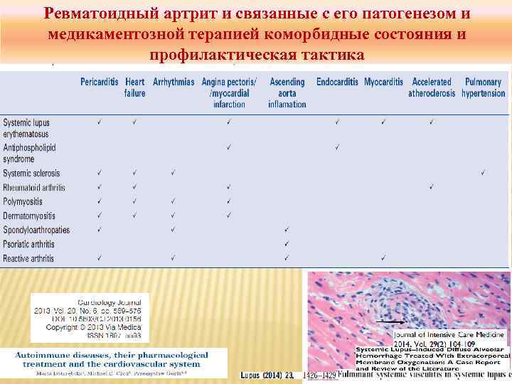 Ревматоидный артрит и связанные с его патогенезом и медикаментозной терапией коморбидные состояния и профилактическая