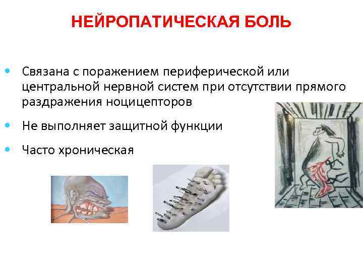 НЕЙРОПАТИЧЕСКАЯ БОЛЬ • Связана с поражением периферической или центральной нервной систем при отсутствии прямого