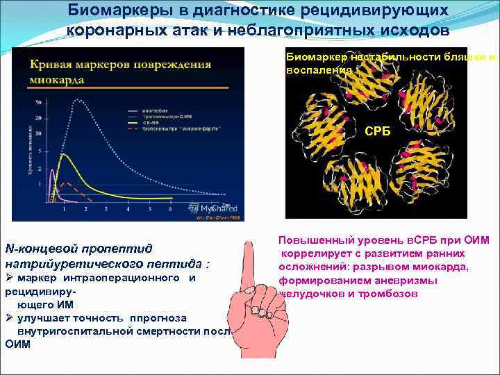 Биомаркеры в диагностике рецидивирующих коронарных атак и неблагоприятных исходов Биомаркер нестабильности бляшки и воспаления