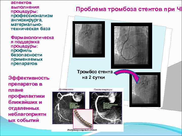 аспектов выполнения процедуры: профессионализм ангиохирурга, материальнотехническая база Фармакологическа я поддержка процедуры: профиль безопасности применяемых