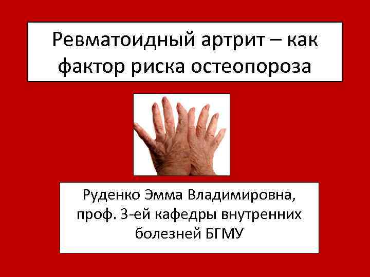 Ревматоидный артрит – как фактор риска остеопороза Руденко Эмма Владимировна, проф. 3 -ей кафедры