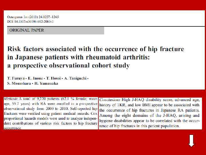 Гиподинамия 