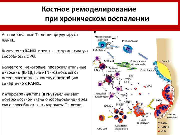 Костное ремоделирование при хроническом воспалении Активированные T клетки продуцируют RANKL. Количество RANKL превышает протективную