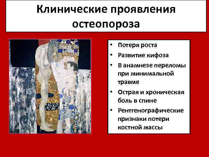Клинические проявления остеопороза • Потеря роста • Развитие кифоза • В анамнезе переломы при