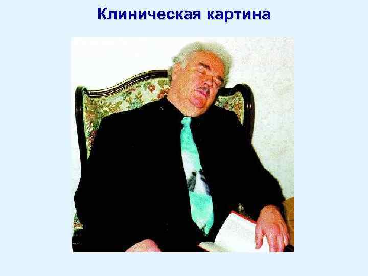 Клиническая картина 