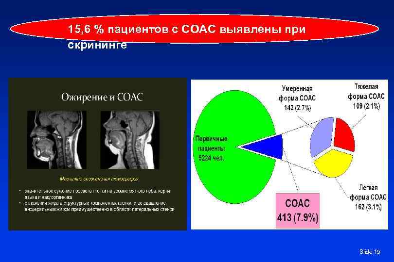 15, 6 % пациентов с СОАС выявлены при скрининге Slide 15 