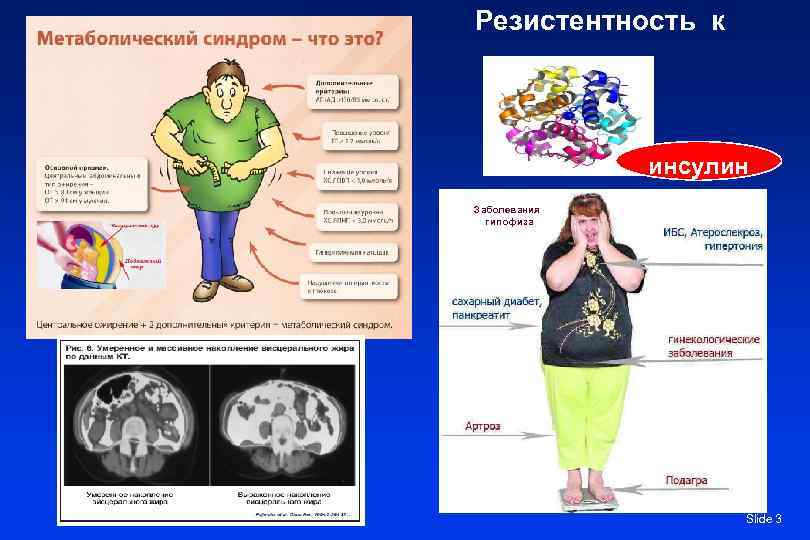 Резистентность к Заболевания гипофиза инсулин у Абдоминальное ожирение Slide 3 
