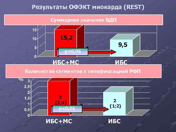 Результаты ОФЭКТ миокарда (REST) Cуммарное значение ВДП p<0, 05 Количество сегментов с гипофиксацией РФП