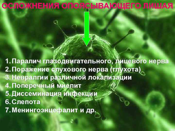 ОСЛОЖНЕНИЯ ОПОЯСЫВАЮЩЕГО ЛИШАЯ 1. Паралич глазодвигательного, лицевого нерва 2. Поражение слухового нерва (глухота) 3.