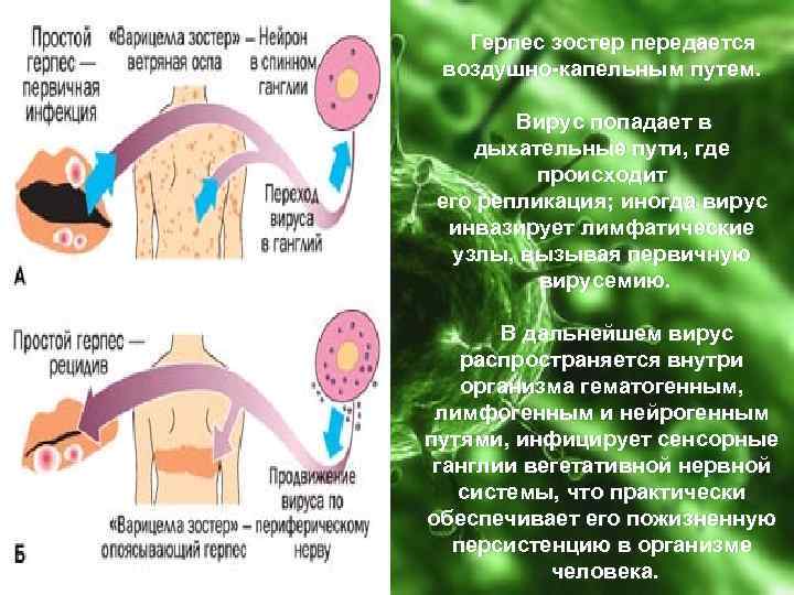  Герпес зостер передается воздушно-капельным путем. Вирус попадает в дыхательные пути, где происходит его