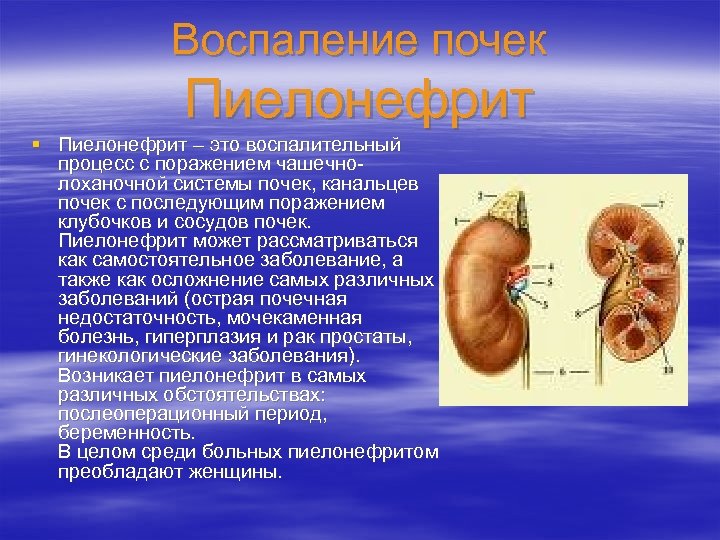 Воспаление почек Пиелонефрит § Пиелонефрит – это воспалительный процесс с поражением чашечнолоханочной системы почек,