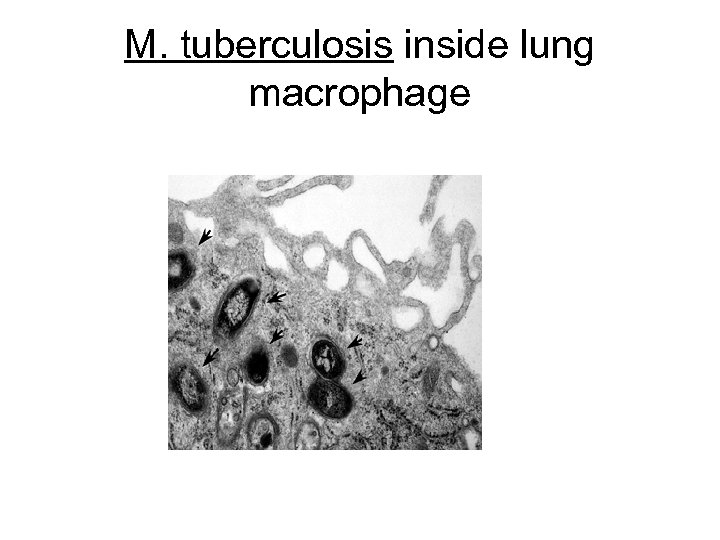 M. tuberculosis inside lung macrophage 