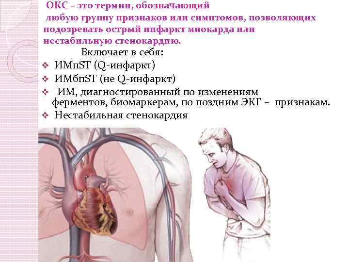  ОКС – это термин, обозначающий любую группу признаков или симптомов, позволяющих подозревать острый