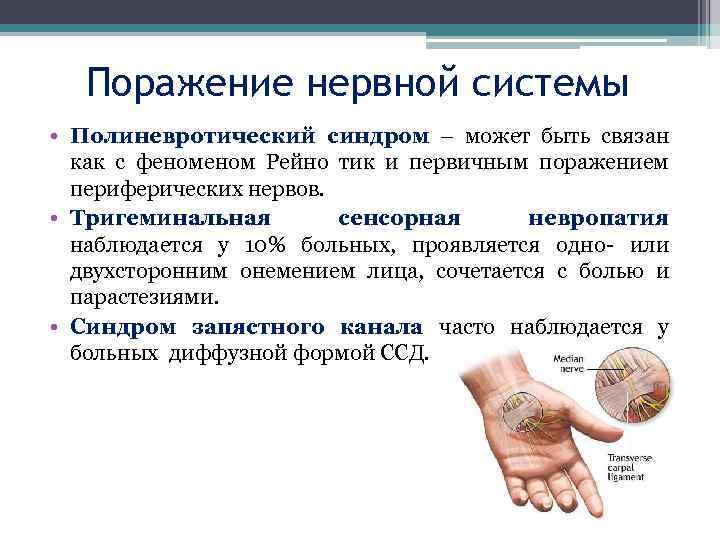 Поражение нервной системы • Полиневротический синдром – может быть связан как с феном Рейно