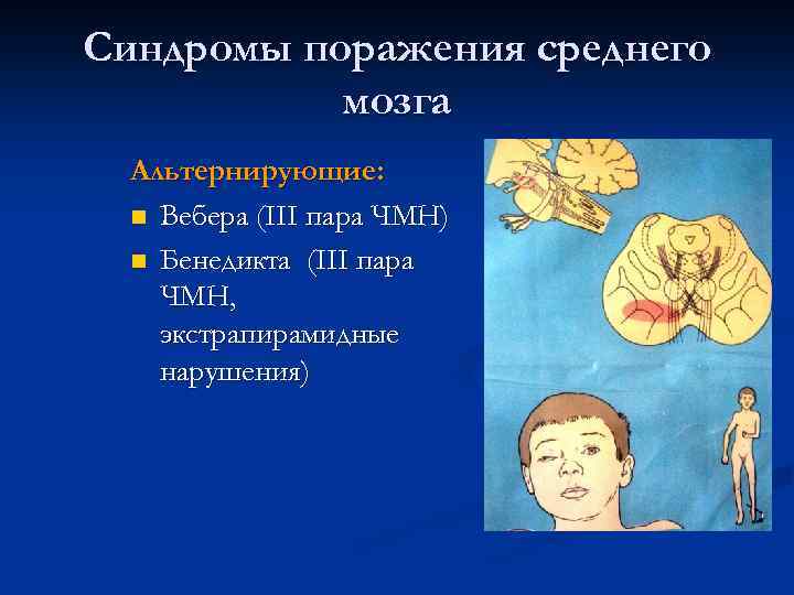 Другие уточненные поражения головного мозга