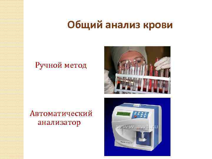 Ручной способ. Ручной метод анализа крови. Общий анализ крови ручным методом. Ручной метод исследования крови. Общий анализ ручной метод.