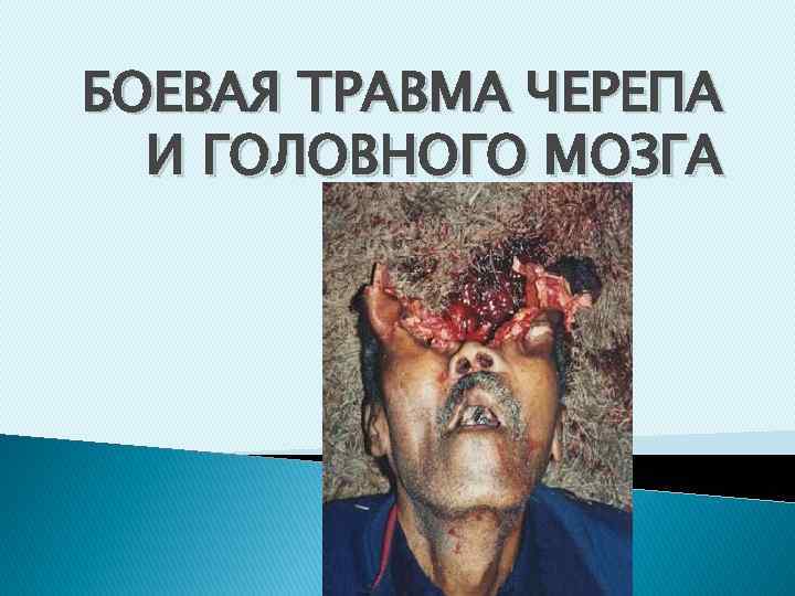 БОЕВАЯ ТРАВМА ЧЕРЕПА И ГОЛОВНОГО МОЗГА 