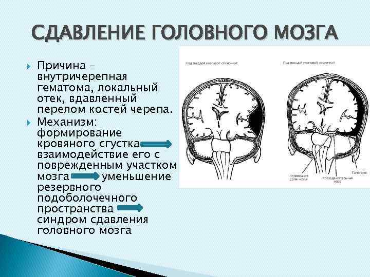 Внутричерепное давление головного мозга. Сдавление головного мозга внутричерепными гематомами. Переломы костей черепа родовой травматизм. Повреждения черепа и головного мозга. Причины сдавления головного мозга.