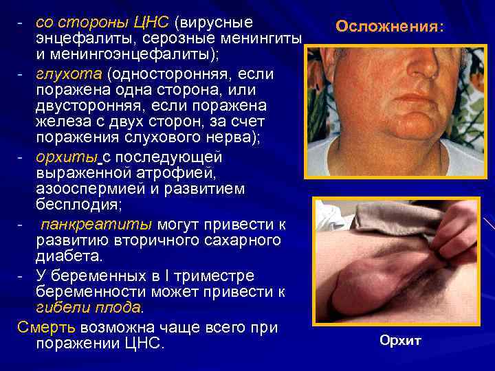 - со стороны ЦНС (вирусные энцефалиты, серозные менингиты и менингоэнцефалиты); - глухота (односторонняя, если