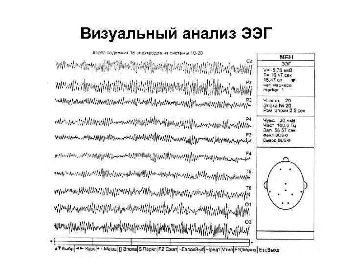 Визуальный анализ ЭЭГ 