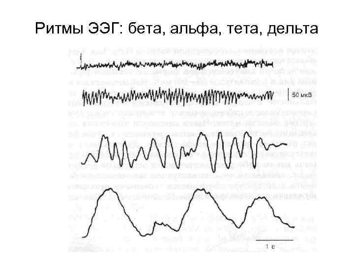 Ритмы ЭЭГ: бета, альфа, тета, дельта 