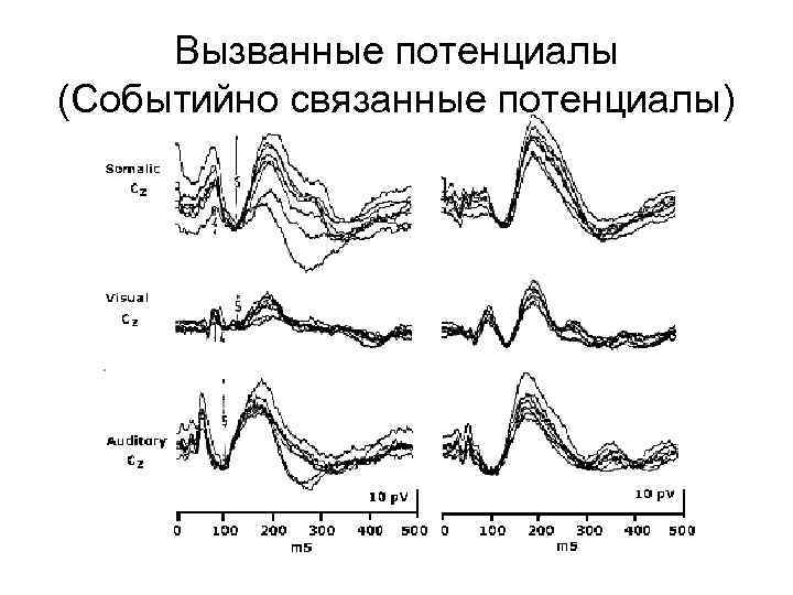 Вызванные потенциалы (Событийно связанные потенциалы) 