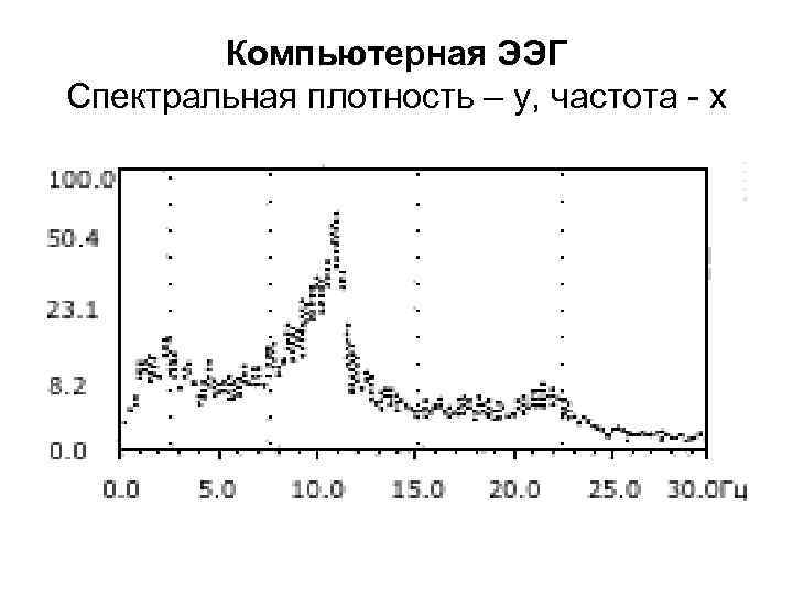 Компьютерная ЭЭГ Спектральная плотность – y, частота - х 