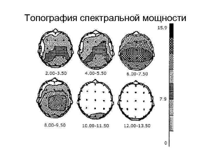Топография спектральной мощности 