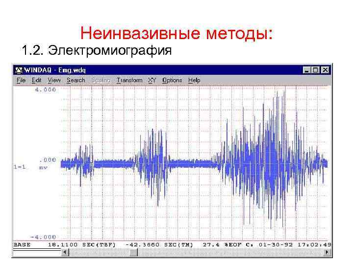 Неинвазивные методы: 1. 2. Электромиография 