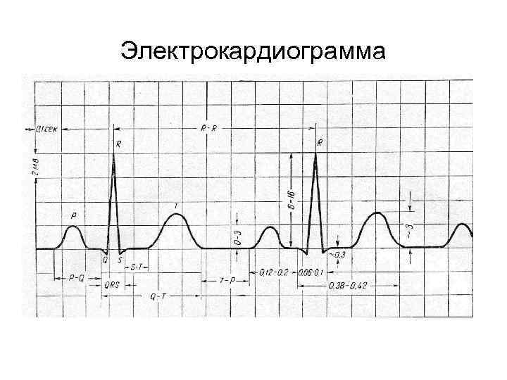 Электрокардиограмма 