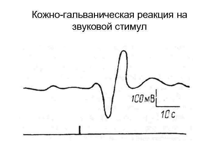 Кожно-гальваническая реакция на звуковой стимул 