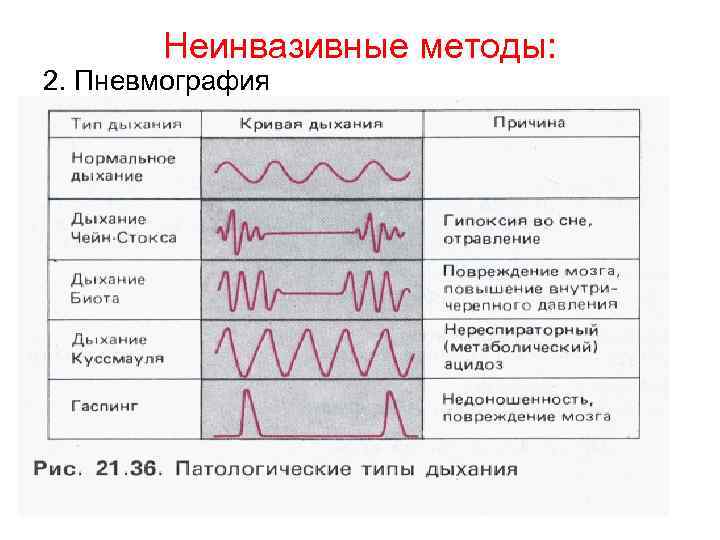 Неинвазивные методы: 2. Пневмография 