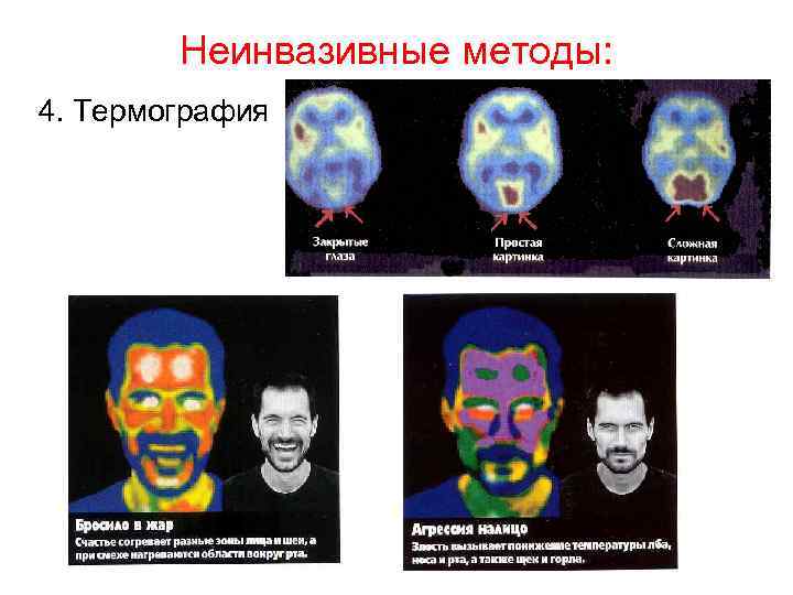Неинвазивные методы: 4. Термография 