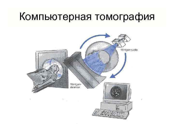 Компьютерная томография 