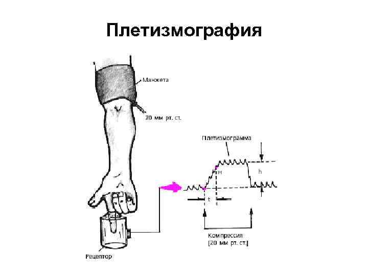 Плетизмография 