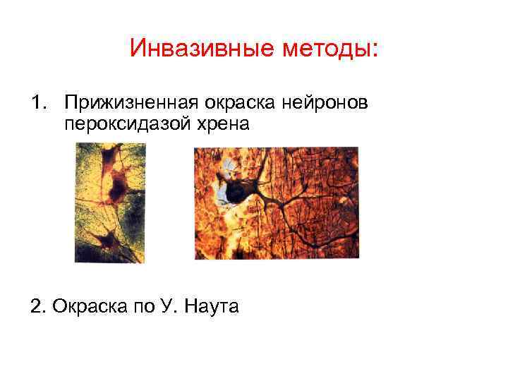 Инвазивные методы: 1. Прижизненная окраска нейронов пероксидазой хрена 2. Окраска по У. Наута 