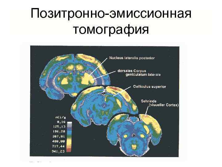 Позитронно эмиссионная томография презентация