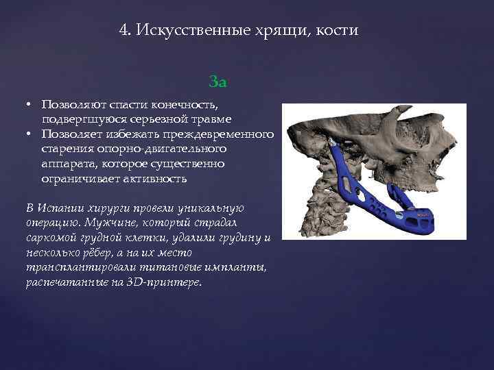 4. Искусственные хрящи, кости За • Позволяют спасти конечность, подвергшуюся серьезной травме • Позволяет