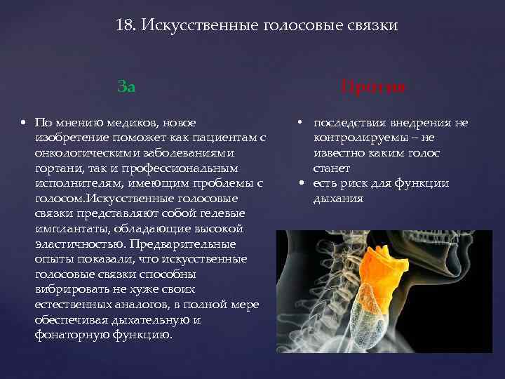 18. Искусственные голосовые связки За • По мнению медиков, новое изобретение поможет как пациентам